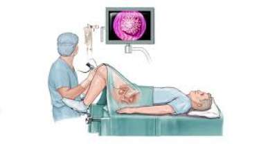 Cystoscopy in Bilaspur