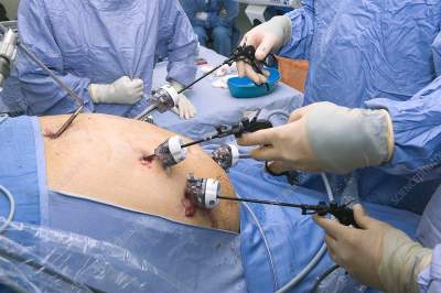 Oesophageal Surgery in Bilaspur